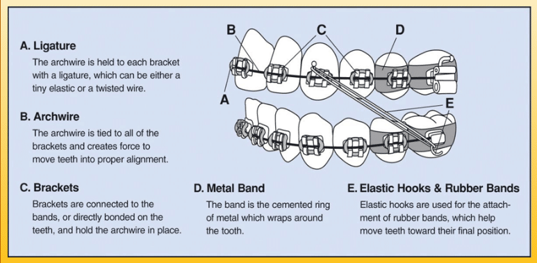 Braces Dung Orthodontics Honolulu and Aiea, HI